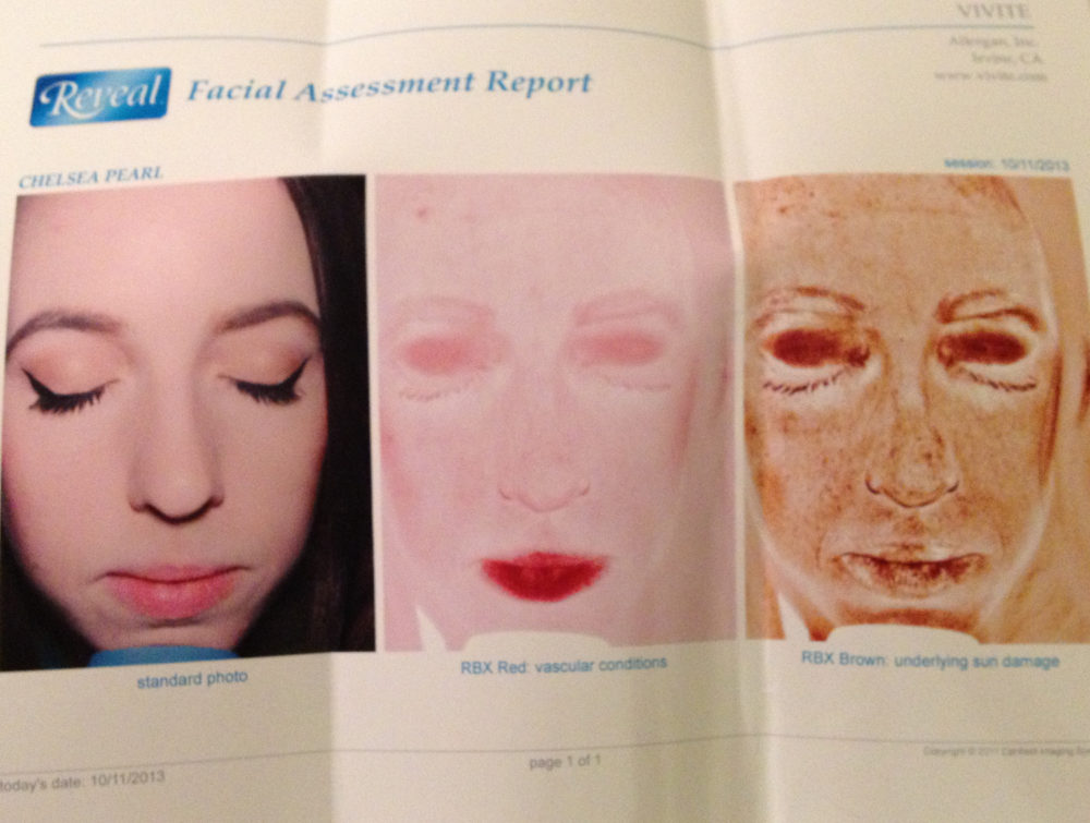 SkinSpirit Reveal Facial Assessment Report