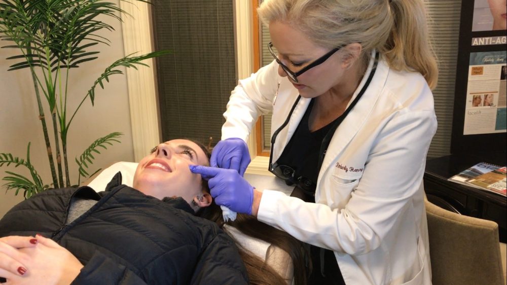 botox in san francisco bay area