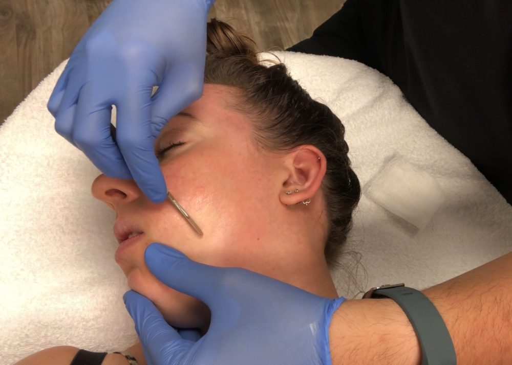 Facial Dermaplaning